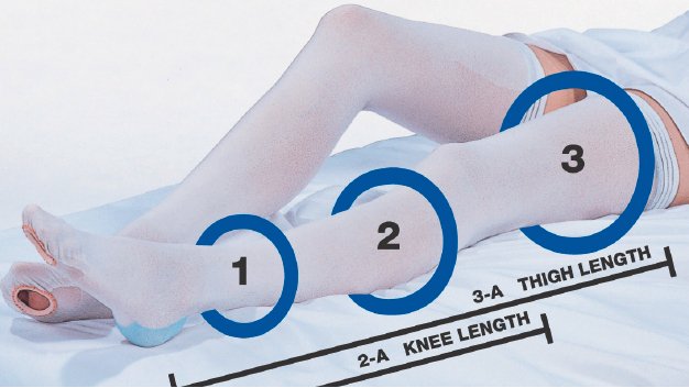 Anti-embolism Stocking Cap® Thigh High X-Large / Short White Inspection Toe
