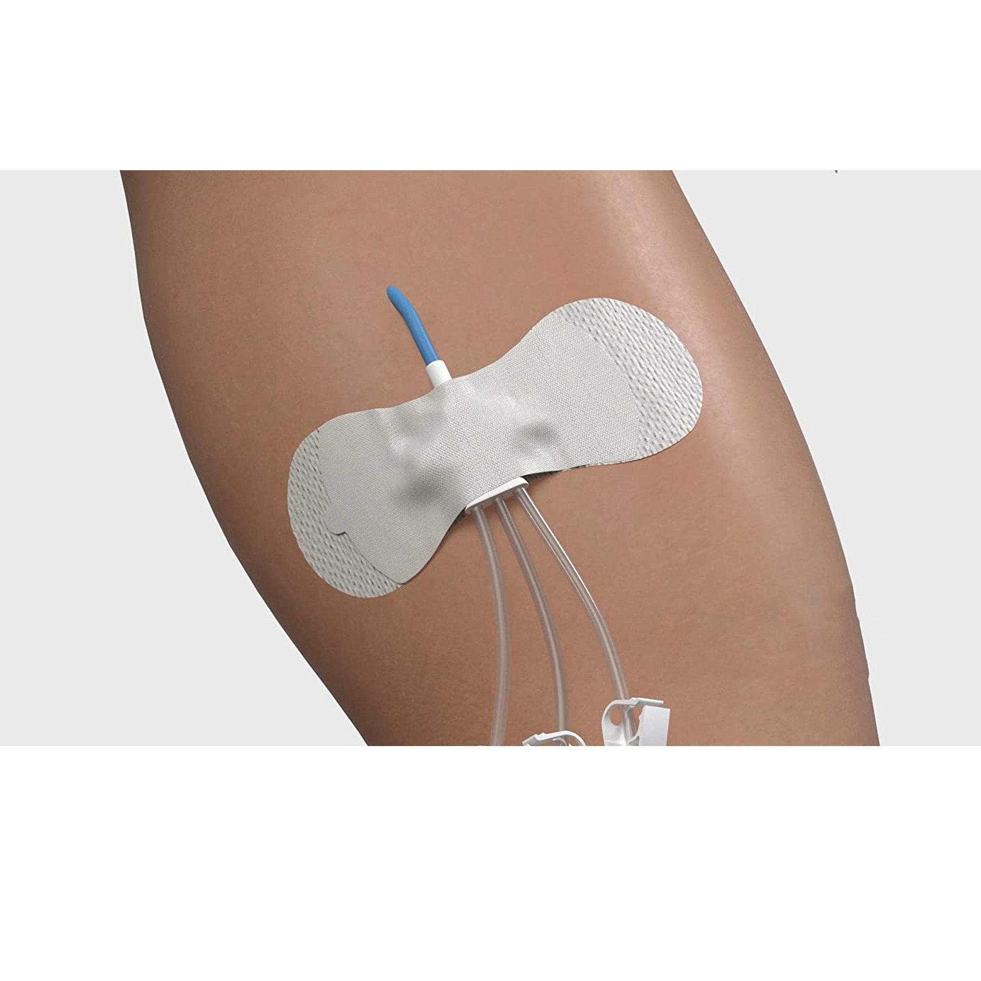 Catheter / Line Securement Device Grip-Lok®