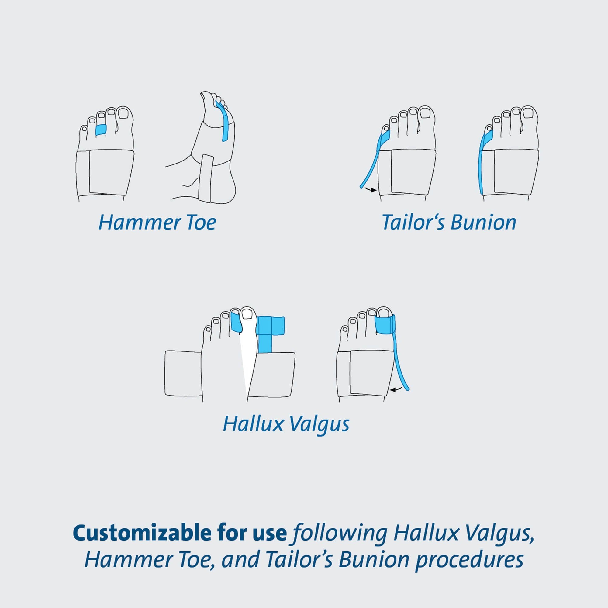 Toe Splint TAS™ One Size Fits Most Strap Closure Foot